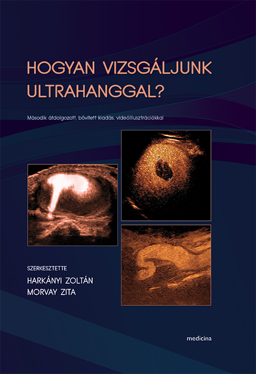 Hogyan vizsgáljunk ultrahanggal videó melléklettel